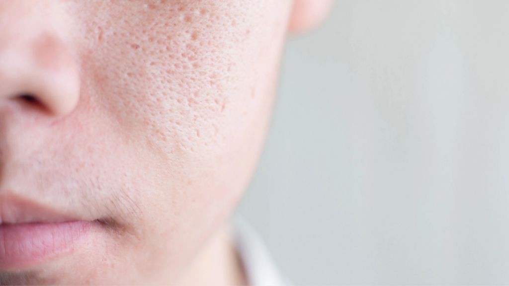 Debunked! 10 Common Skincare Myths You Need To Stop Believing